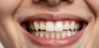 Straighten Your Smile at Any Age: Adult Orthodontics for Confidence