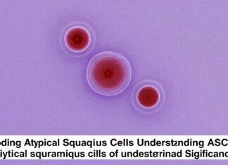 Decoding Atypical Squamous Cells: Understanding ASC-US