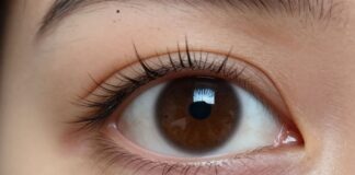 Understanding and Treating Black Spots in Your Vision