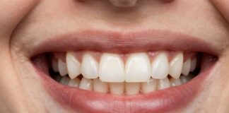 Transform Your Smile with Cosmetic Dental Bonding