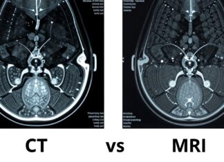 CT vs MRI: Choosing the Right Imaging Test for You