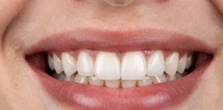 Restore Your Smile with Durable Dental Veneers for Missing Teeth