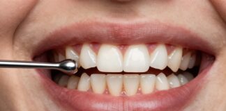 Restore Your Smile: Expert Fractured Tooth Repair Solutions