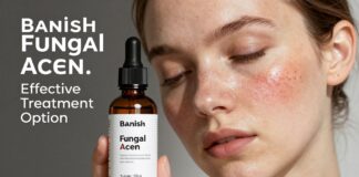 Banish Fungal Acne: Effective Treatment Options