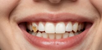 Enhance Your Smile Naturally with Gummy Bear Implants