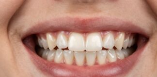 Protect Your Smile with a Custom Hawley Retainer