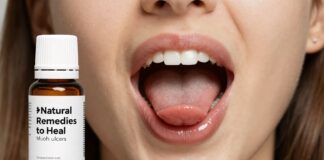 5 Natural Remedies to Heal Mouth Ulcers Fast