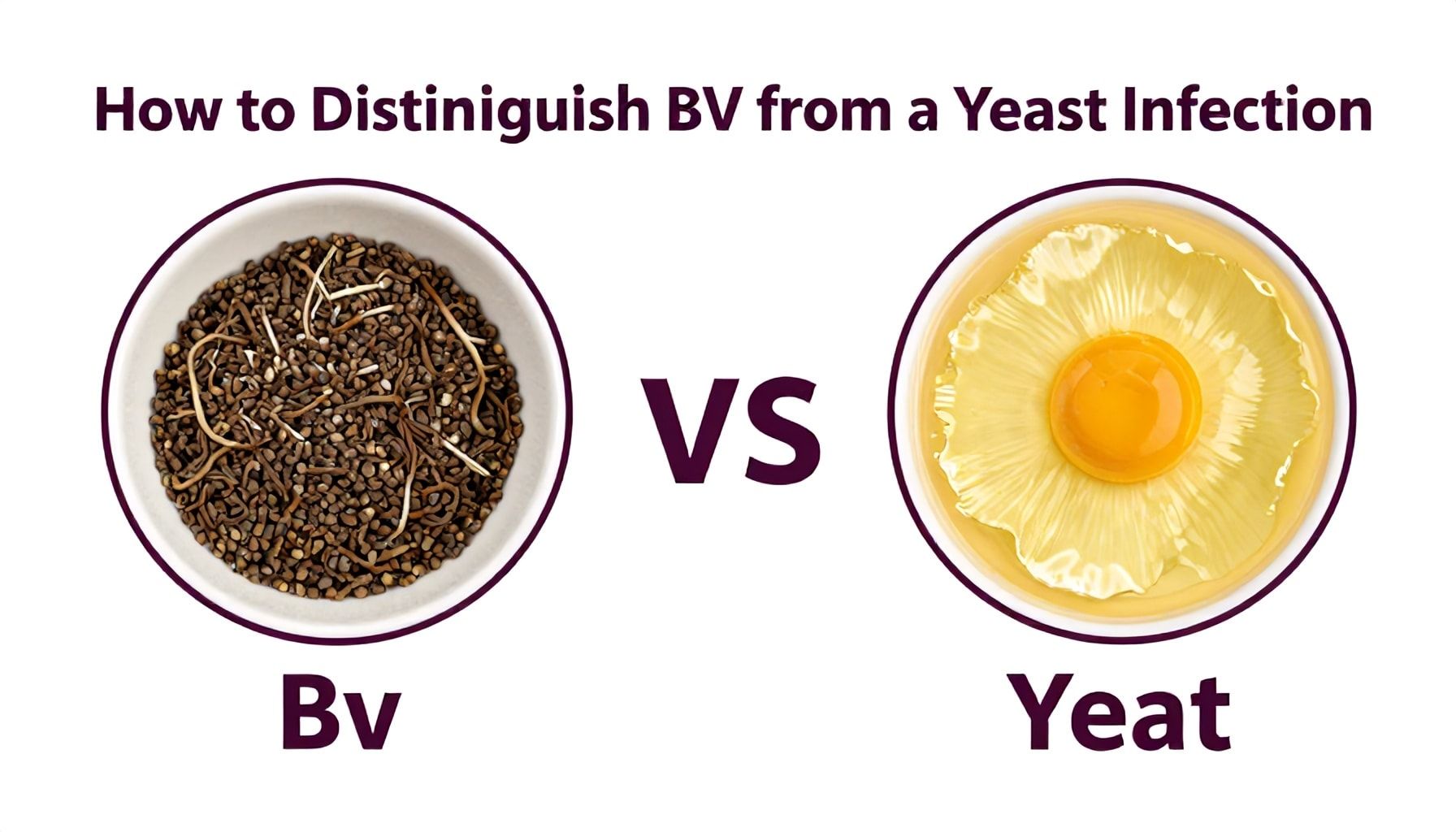 How to Distinguish BV from a Yeast Infection*