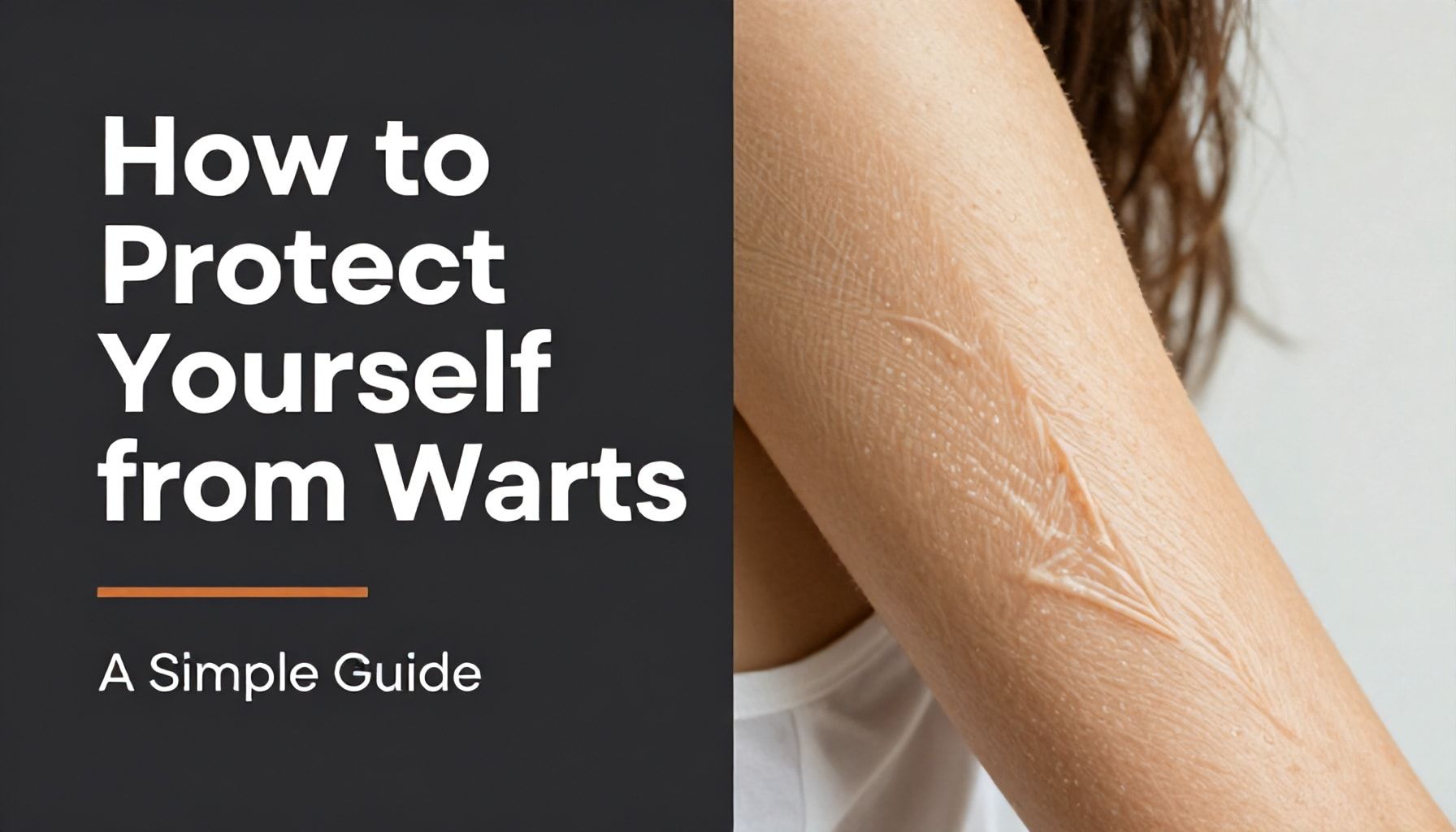 How to Protect Yourself from Warts: A Simple Guide*