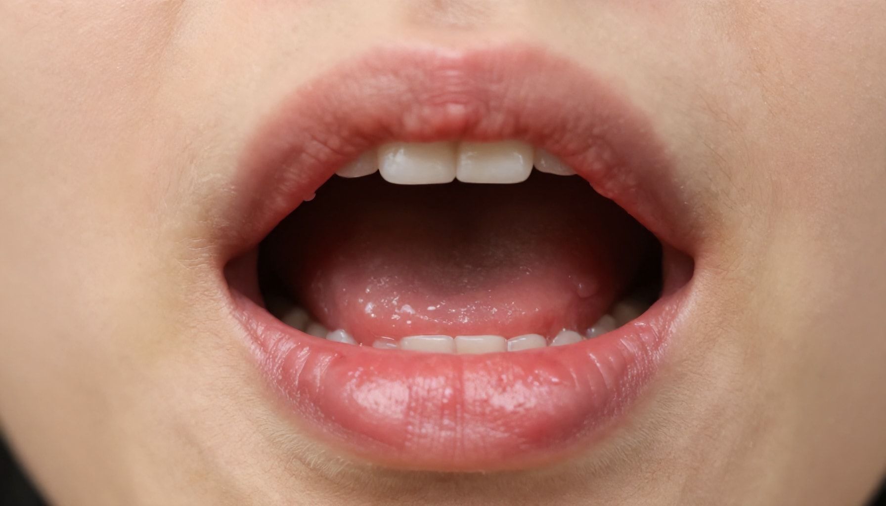 How to Spot a Dry Socket Before It Gets Worse*