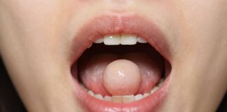 Understanding and Treating Lumps in Your Mouth’s Roof