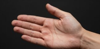 Uncover the Hidden Meaning Behind an Itchy Left Palm