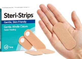 Steri-Strips: Gentle, Skin-Friendly Wound Closure for Faster Healing