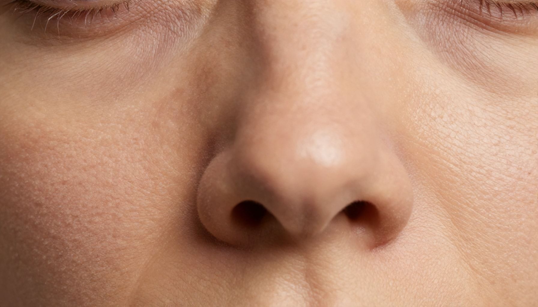 The Truth About Fibrous Papules: Are They Harmful or Just Cosmetic?*