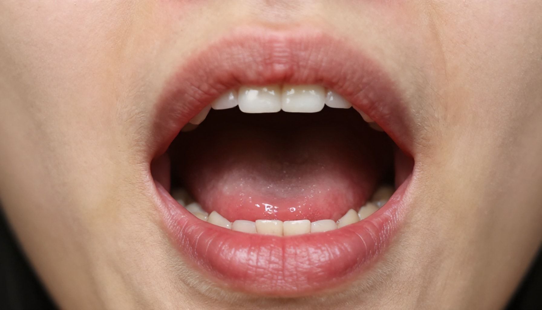 The Truth About Why Dry Socket Happens More Often Than You Think*