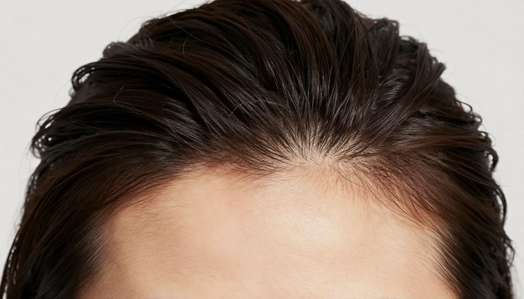 The Truth About Why Your Hairline Is Receding (And How to Fix It)"*