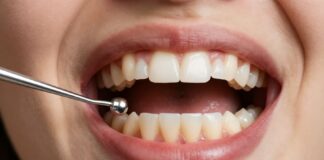 Recognize Tooth Infection Symptoms Early for Faster Relief