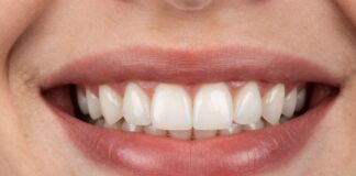 Transform Your Smile with Durable, Natural-Looking Veneers