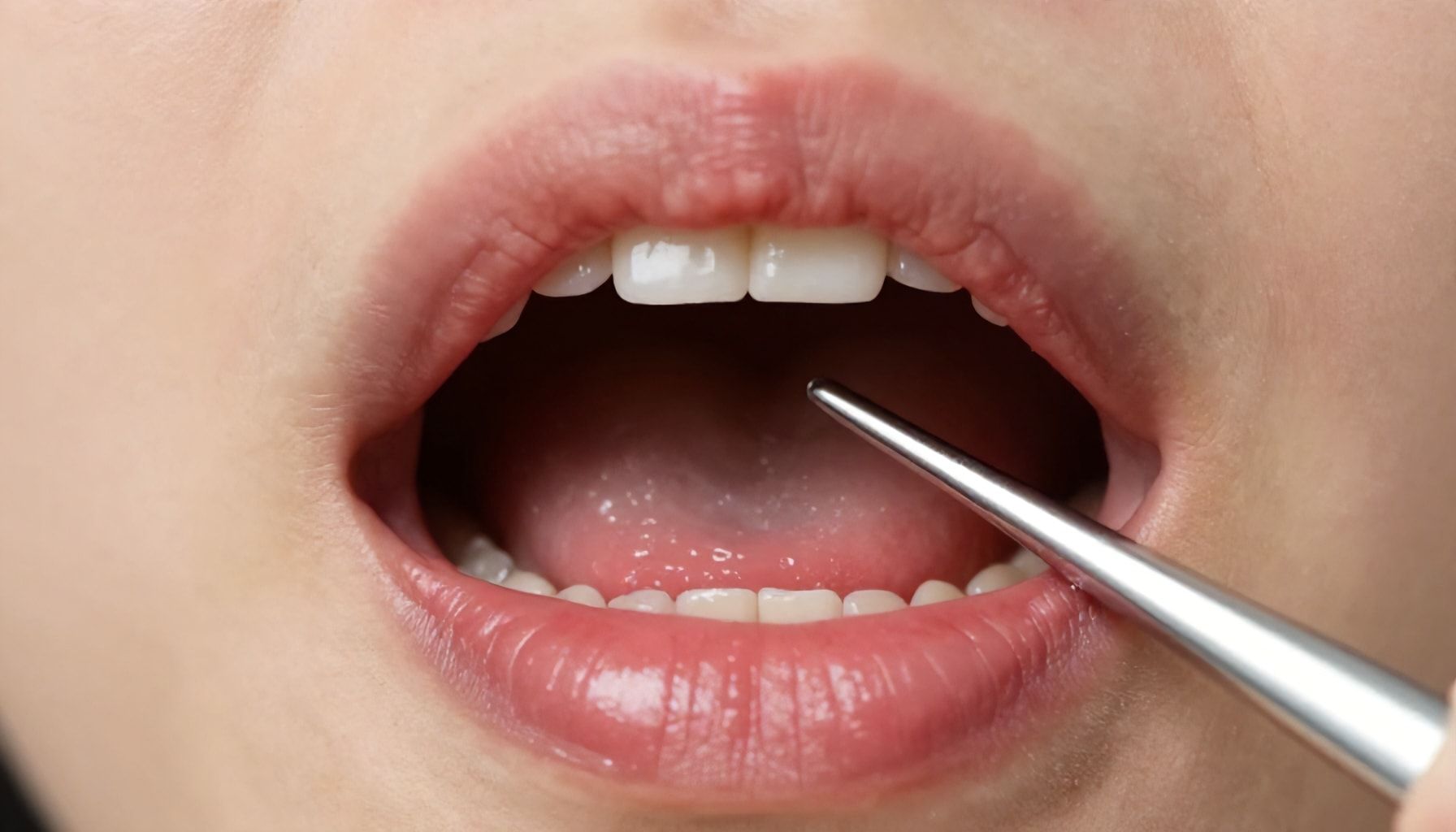 Why a Dry Socket Hurts More Than a Normal Tooth Extraction*