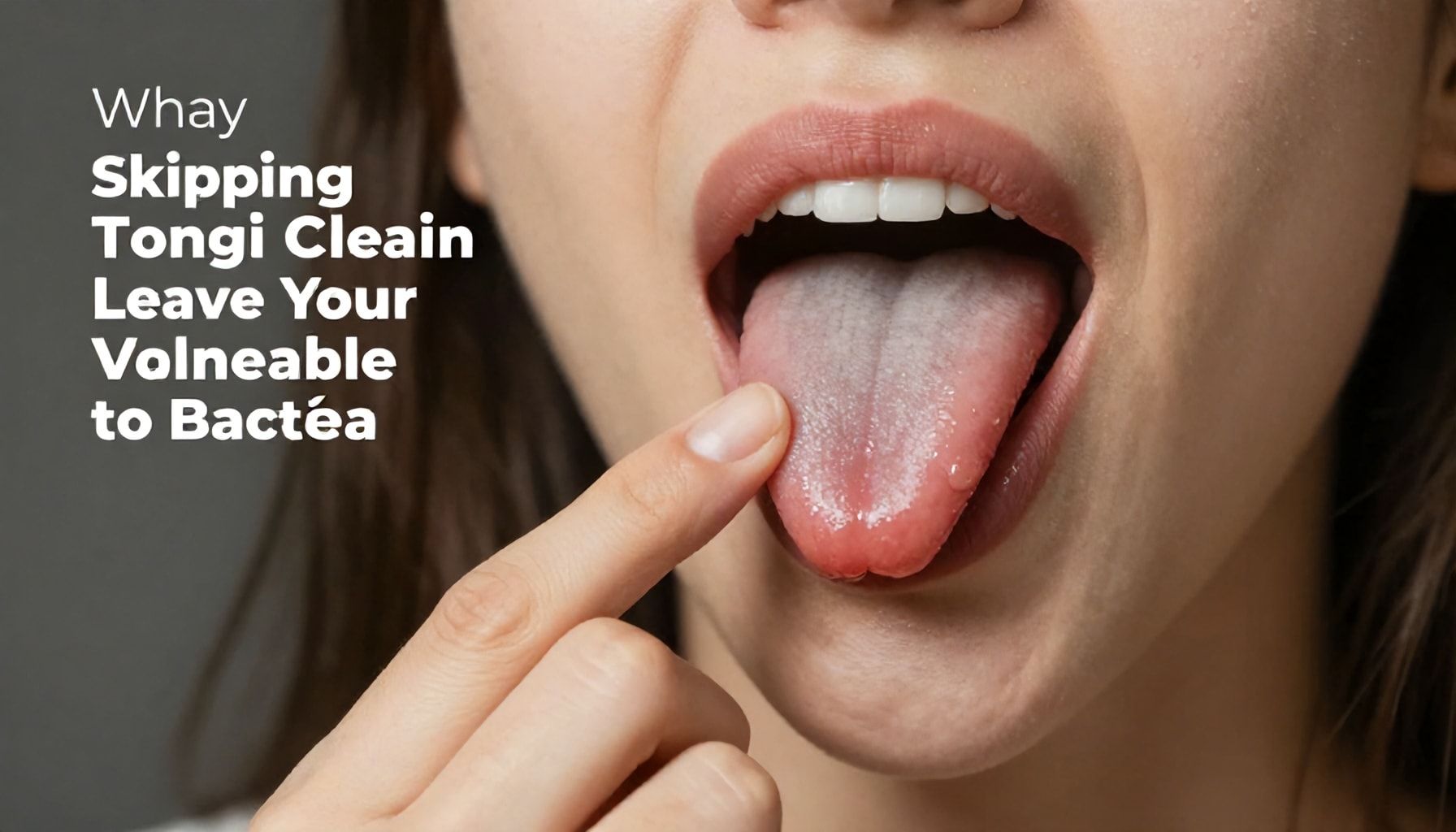 Why Skipping Tongue Cleaning Leaves Your Mouth Vulnerable to Bacteria*