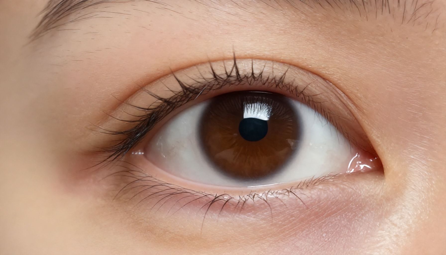 Why Styes Aren’t Always Contagious (And When to Worry)*