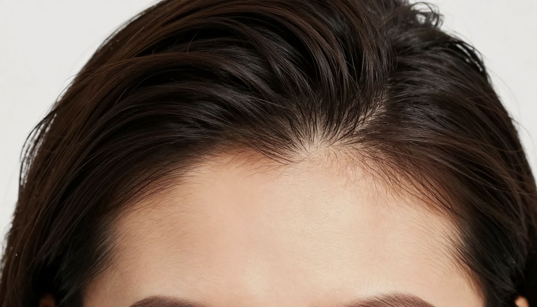 Why Your Diet and Lifestyle Are Making Your Hairline Worse"*