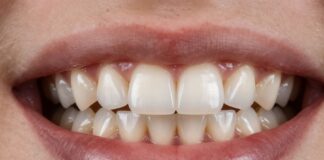 Durable Zirconia Bridges: Strong, Natural-Looking Tooth Replacement