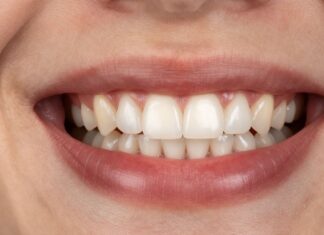 Unlock Your Smile: Mastering the Zygomaticus Muscle